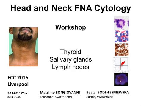 Pdf Head And Neck Fna Cytology Cytopathology Head And Neck Fna