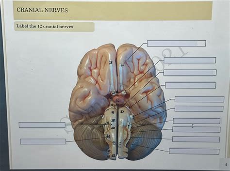 Solved Cranial Nerveslabel The 12 ﻿cranial Nerves