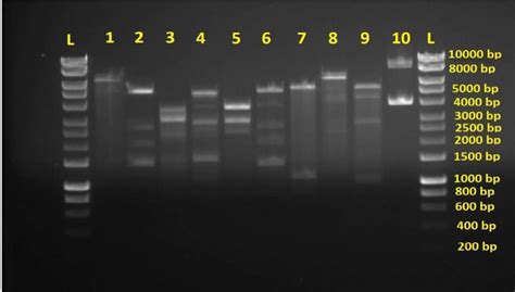 Agarose Gel Electrophoresis Of Plasmids Digested By Bamhi And Hindiii