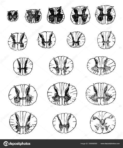 Microscopio De Secci N Transversal De La M Dula Espinal