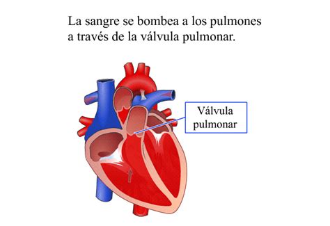 PatEdu Reemplazo de válvulas del corazón