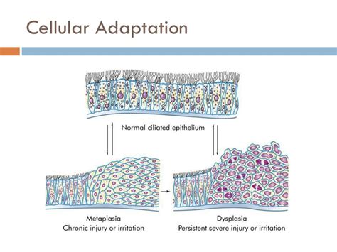 Ppt Altered Cellular And Tissue Biology Powerpoint Presentation Free