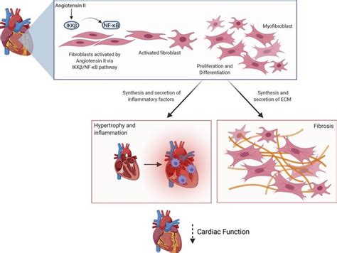 JCI Insight Fibroblast specific IKK β deficiency ameliorates