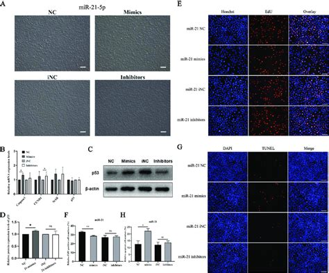 The Effects Of MiR 21 5p On Proliferation And Apoptosis In TM3 Cells