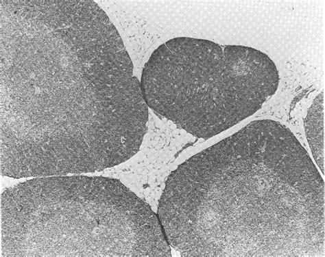 Tetanus Antitoxin | Semantic Scholar