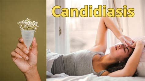 DESPIDETE de la CANDIDIASIS VAGINAL causas síntomas TRATAMIENTO