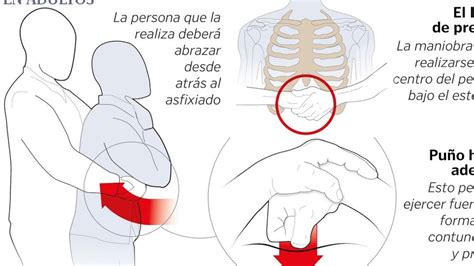 Cómo se hace la maniobra de Heimlich el método que puede salvar una