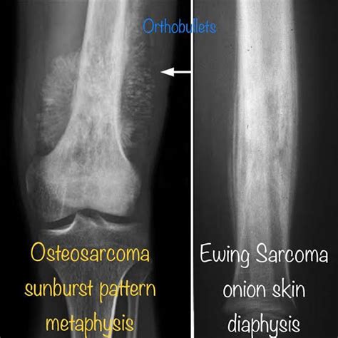 Pin By Aleksandra Stawik On Medyczne Medical Radiography Radiology