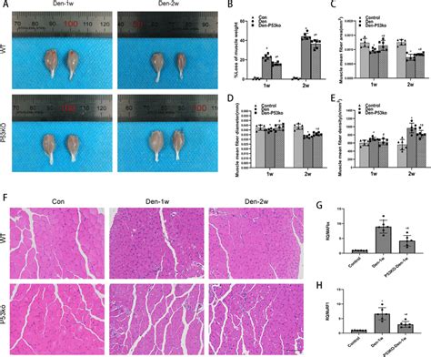 Attenuated Denervated Muscle Atrophy Using P Ko A B Appearance And