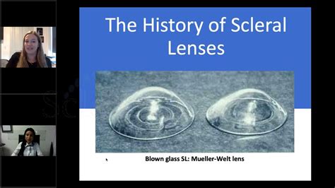 A Guide To Scleral Lens Terminology And Clinical Protocols 062321 Youtube