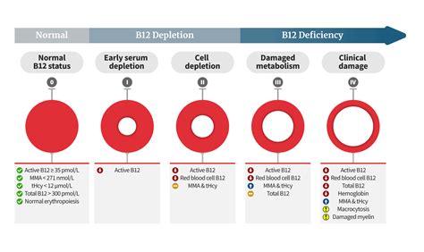 The 4 Stages of B12 Deficiency (Symptoms Included) • PA Relief