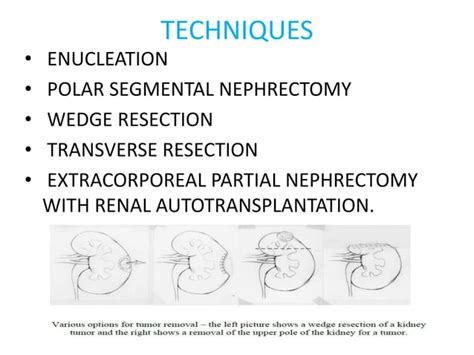 partial nephrectomy pptx blood disorders diseases  conditions
