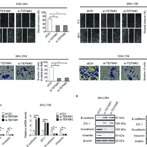 Tefm Knockdown Suppressed Hcc Cell Invasion And Migration Through