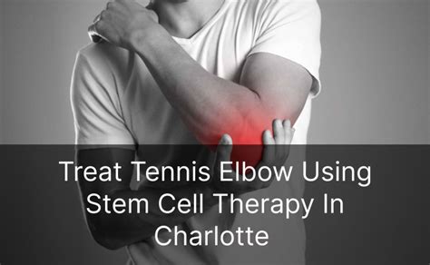 Stem Cell Therapy For Tennis Elbow Stem Cell Carolina