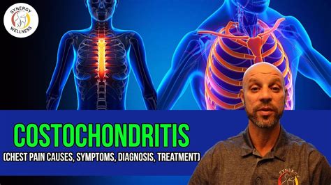 Costochondritis Pain Symptoms