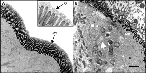 Salmonella Enterica Microscope - Mijacob