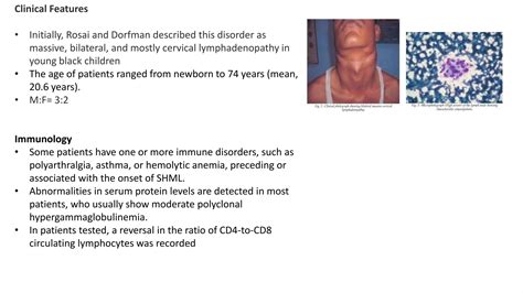 Cervical Lymphadenopathy Ppt