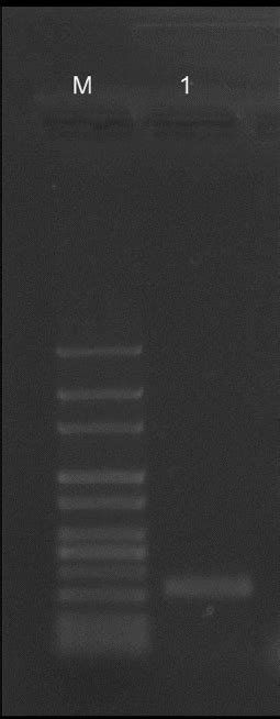 PCR Ampli Fi Cation Of The Aac 6 0 Aph 2 0 Ia Gene 348 Bp