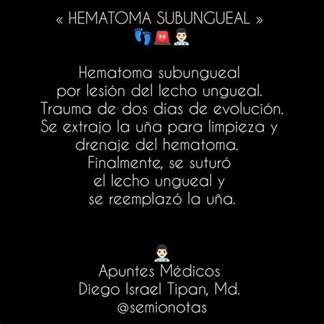 Hematoma Subungueal Apuntes M Dicos Dr Israel Apuntes M Dicos