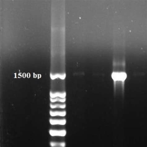 Agarose Gel Electrophoreses Of The Amplified 16s Rrna Gene Of Isolate