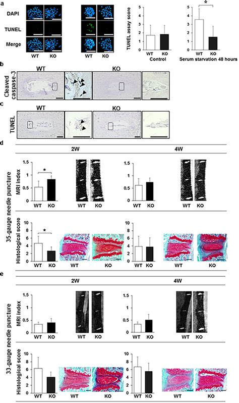 Caspase Knockout Ko Increases The Resistance Of Nucleus Pulposus