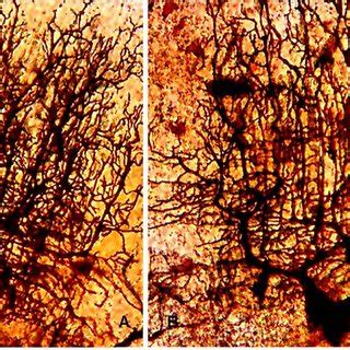 A Purkinje Cells From The Vermis Of The Cerebellum From A Normal