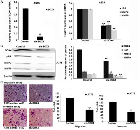 Sox Promotes Melanoma Cell Migration And Invasion Though The