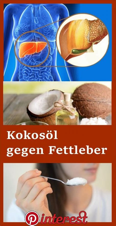 Kokosöl gegen Fettleber Fettleber Natürliche gesundheit Kokosöl