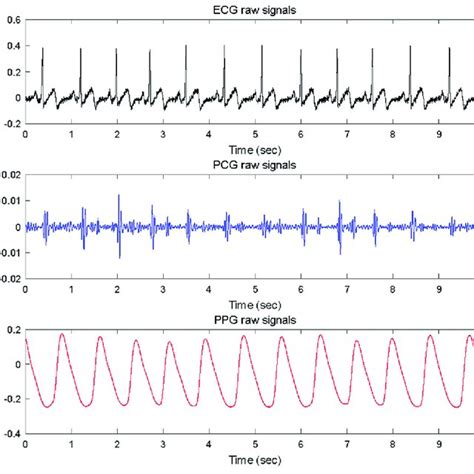 Example Of Plots Of Simultaneously Recorded Ecg Pcg And Ppg Signals