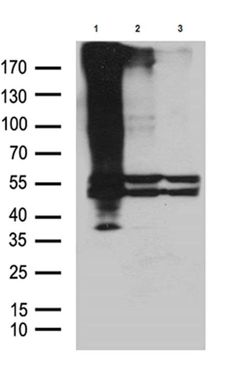 Gpr Monoclonal Antibody Oti C Truemab Origene L