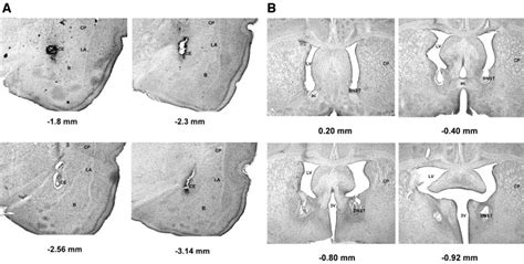 Lesions In The Bed Nucleus Of The Stria Terminalis Disrupt