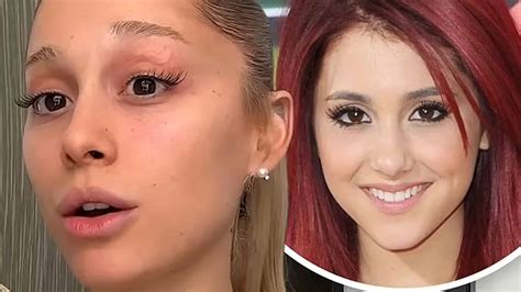 Did Ariana Grande Get Plastic Surgery SurgeryTR