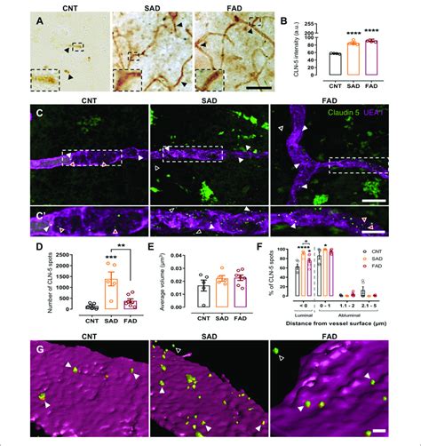 CLN 5 Spots Are Increased In The Brain Microvasculature Of AD