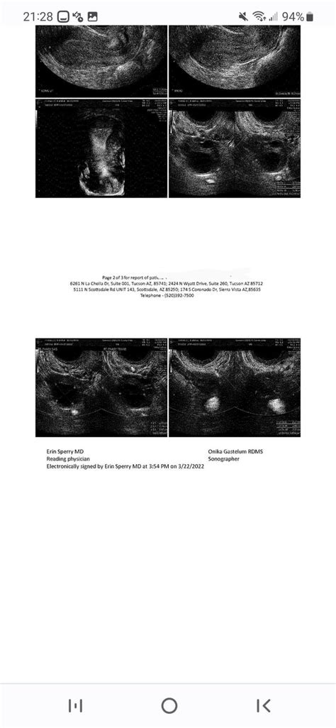 Ultrasound : r/endometriosis