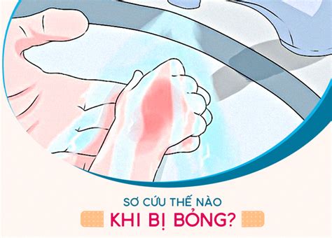 SƠ CỨu ThẾ NÀo Khi BỊ BỎng Bệnh Viện Quốc Tế Mỹ Aih