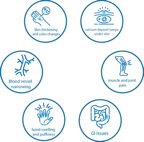 Symptoms and Causes - SclerodermaIndia