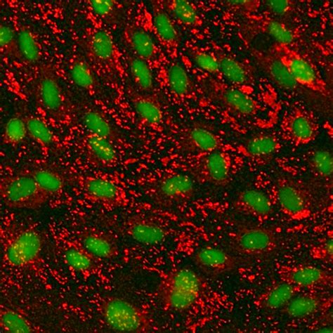 Human Cervical Microvascular Endothelial Cells Innoprot Cervix Cells