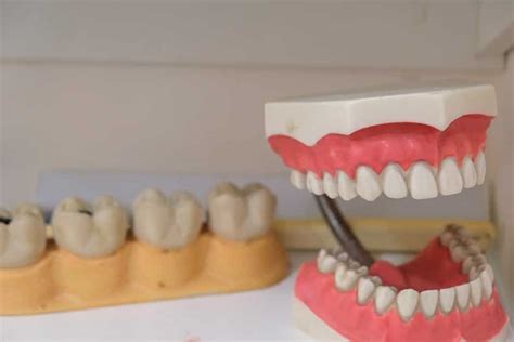 What to Expect for Your First Denture Procedure