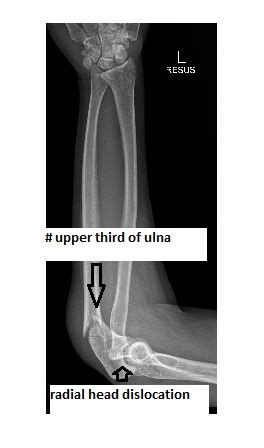 Imaging Case Of The Week 248 Answer Emergucate