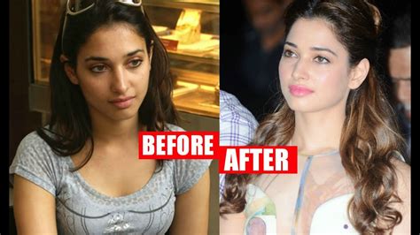 How Plastic Surgery Transformed B Actresses Into Divas