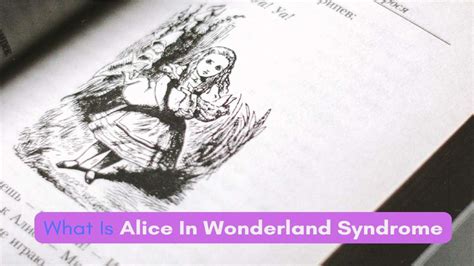 What Is Alice In Wonderland Syndrome Aws Causes Symptoms And