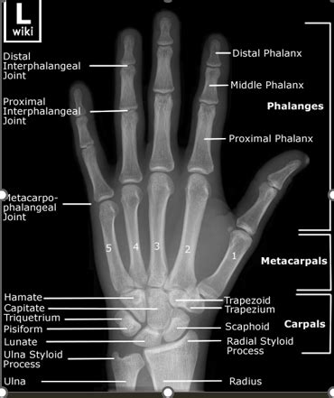 Hand Wrist Elbow X Ray Positioning Flashcards Quizlet