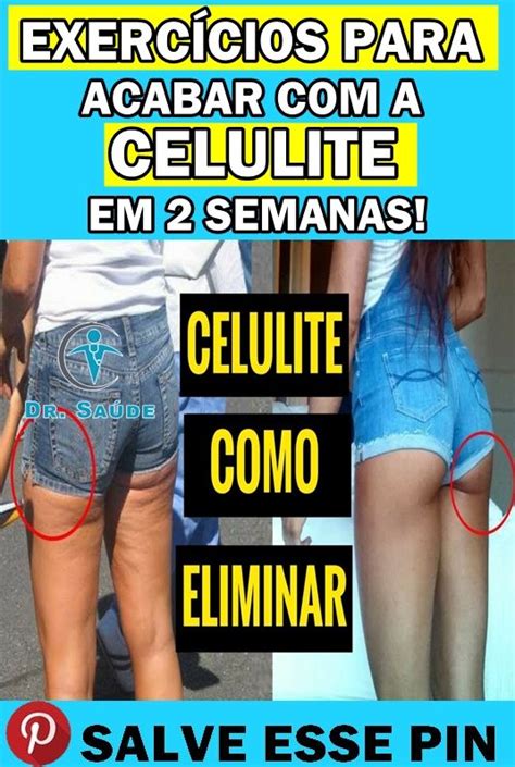 As 8 Receitas Para Eliminar A Celulite Celulite Celulite Antes E