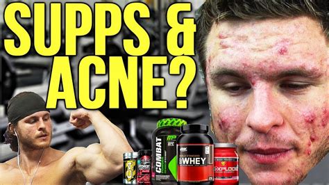 Which Bodybuilding Supplements Cause Acne Creatine Protein Etc