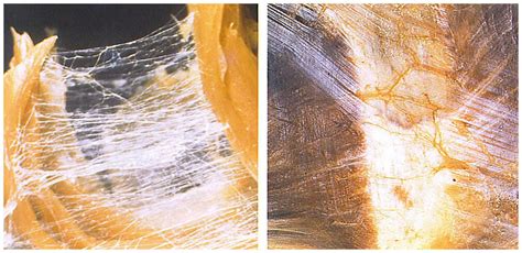 fascia  posture understanding  significance