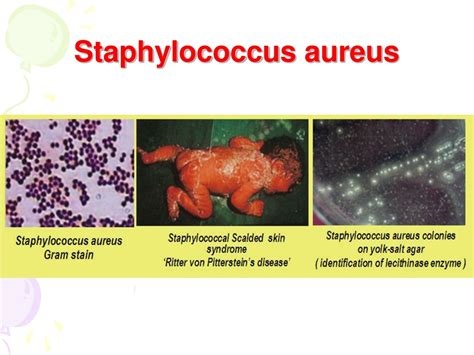 Ppt Pathogenic Cocci Staphylococci Streptococci Neisseria