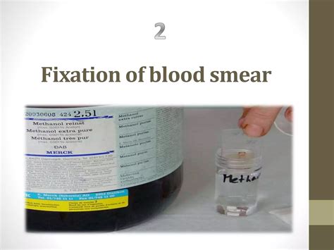 Blood smear staining | PPT