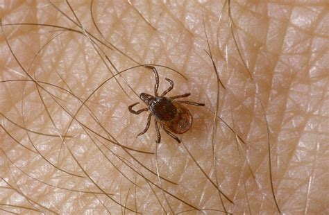 Which Disease Can You Catch From A Tick Bite Lyme Disease Symptoms Cure And Precautions Metro News