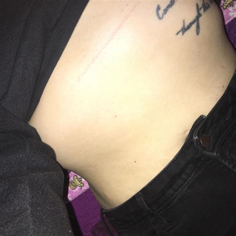 Sports bra rash- I noticed this rash that’s right in line with where my