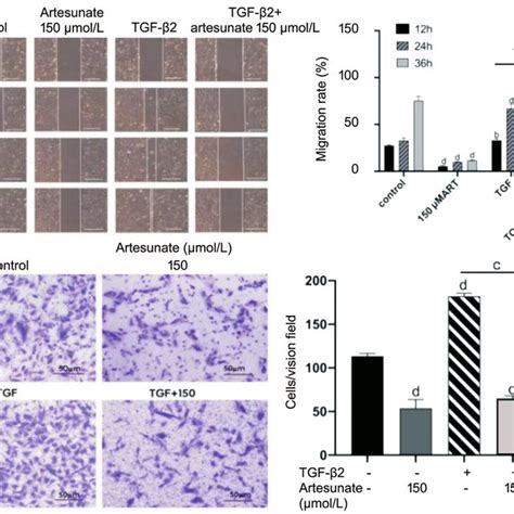 Artesunate inhibited TGF β2 mediated migration of ARPE 19 cells After